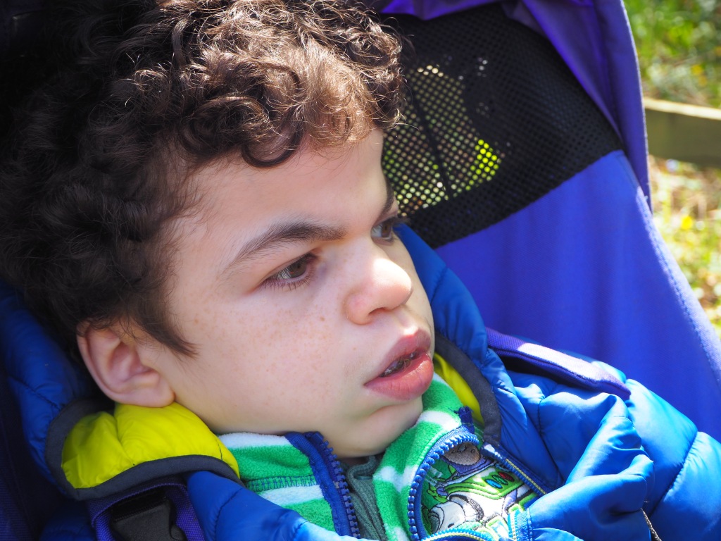 A close up. Boy with features of Hunter Syndrome, reclining in a disability buggy looking off to the side.